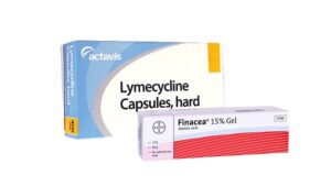 Lymecycline and Azelaic Acid gel